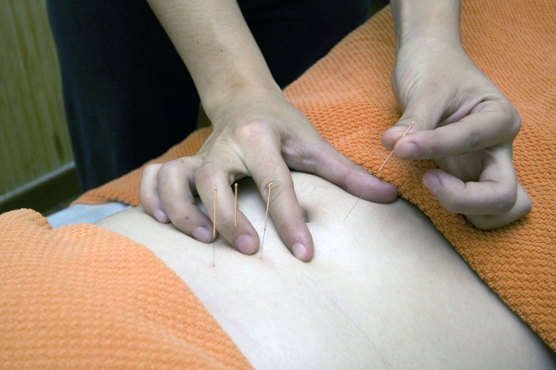 osteopathe-ESCRAGNOLLES-min_acupuncture-4175625